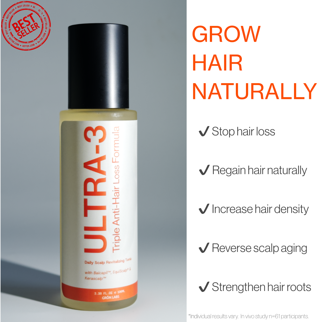 Bottle of ULTRA-3, a hair tonic that stops hair loss, regains hair naturally, increases hair density, reverses scalp aging, and strengthens hair roots