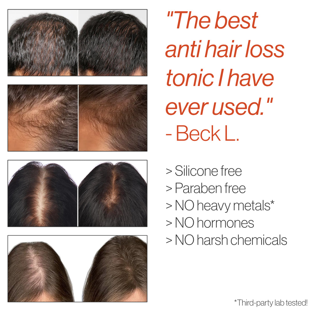 Triple Anti Hair Loss Formula - ULTRA-3