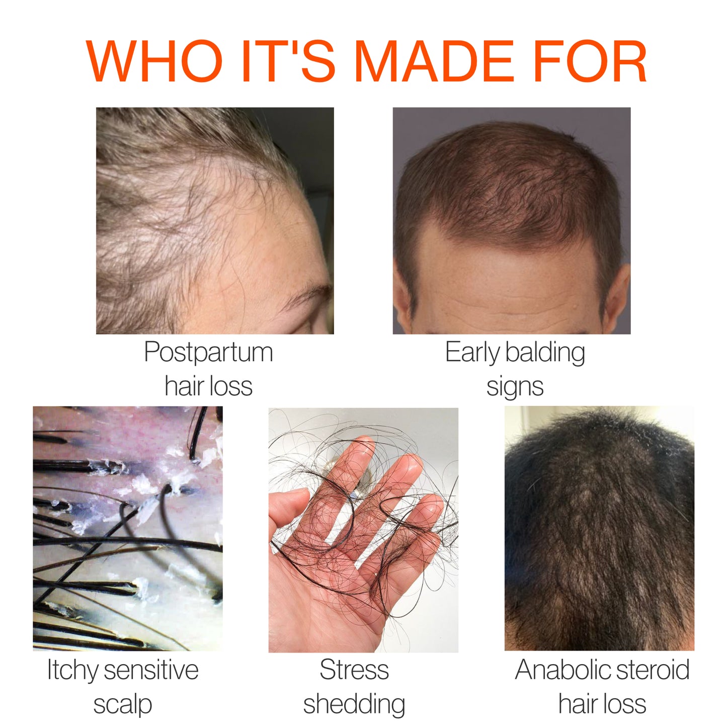 Product advertisement for hair care solutions targeting postpartum hair loss, early balding signs, itchy sensitive scalp, stress shedding, and anabolic steroid hair loss.